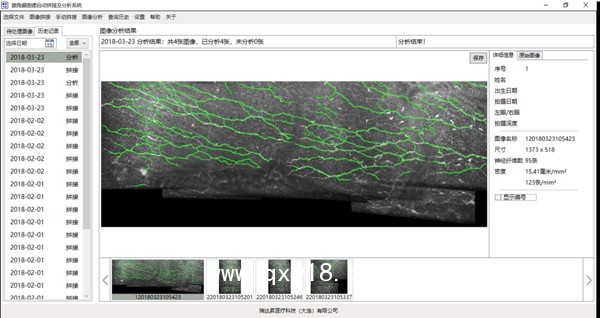 眼角膜圖像自動拼接及分析系統(tǒng)