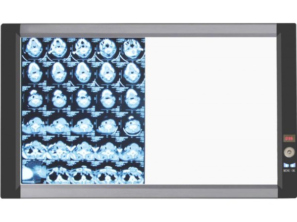 山東眾佳ZJ-G2B 系列LED醫(yī)用超薄液晶觀片燈