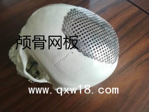 神經(jīng)外科腦外科手術(shù)器械鈦網(wǎng)顱骨網(wǎng)板連接片