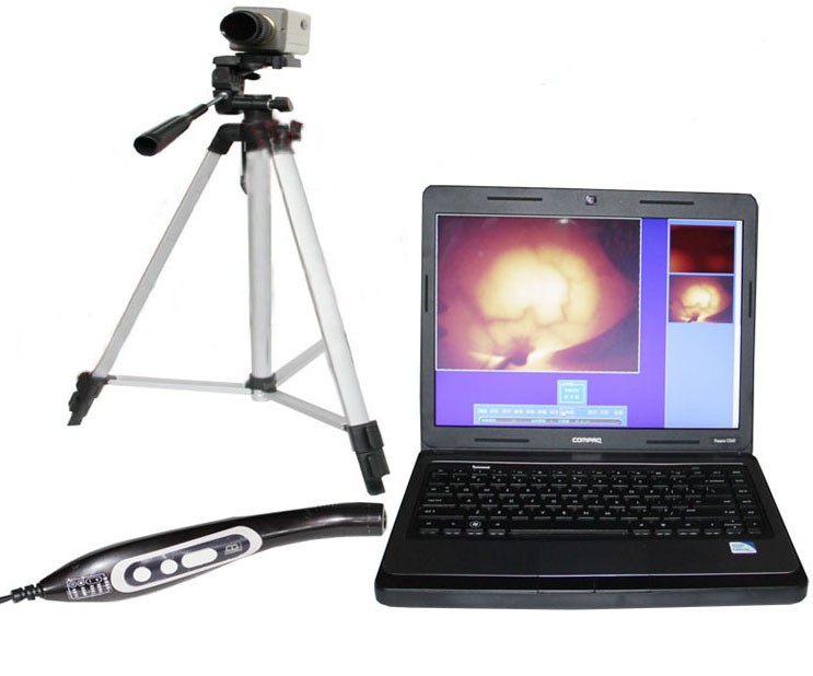 供應(yīng)乳腺病檢測分析儀（紅外線乳透機）