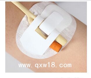 體表導管固定裝置