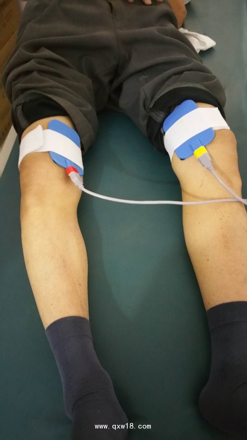 三樂(lè)SDZP-ID中醫(yī)定向治療儀