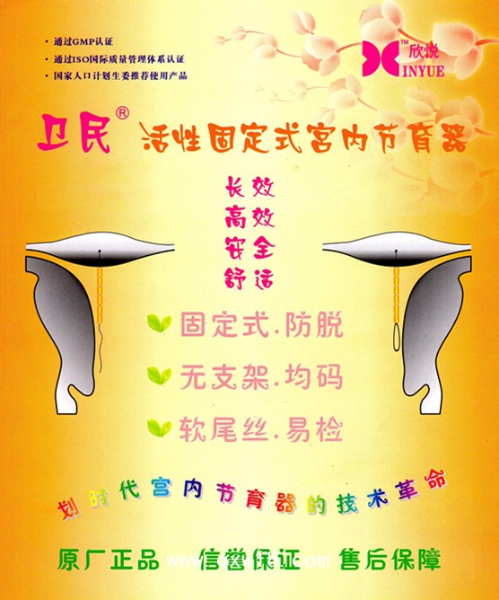 固定式宮內(nèi)節(jié)育器