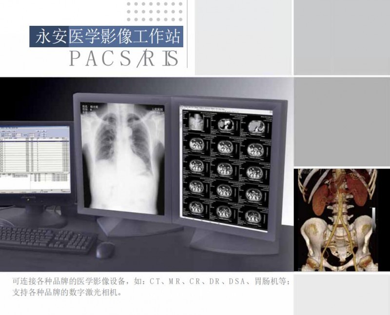 影像工作站（超聲、DR、CT、核磁）軟件廠家