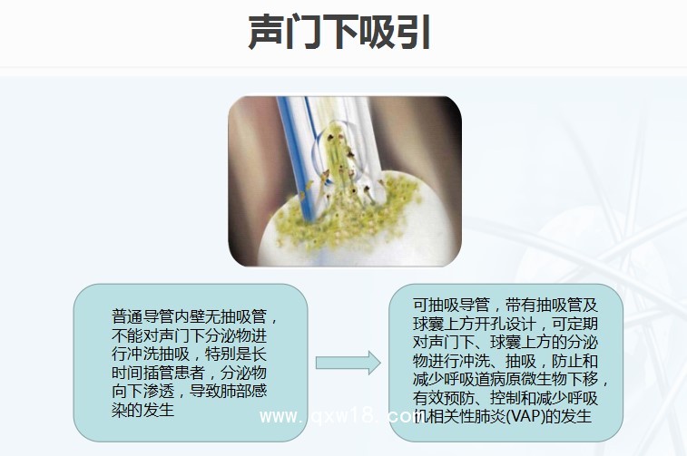 《麻醉重癥》可抽吸加強(qiáng)型氣管插管（聲門下吸引）
