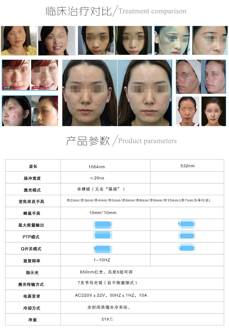 調(diào)q激光治療儀皮膚科激光治療儀關(guān)于調(diào)q激光治療雀斑