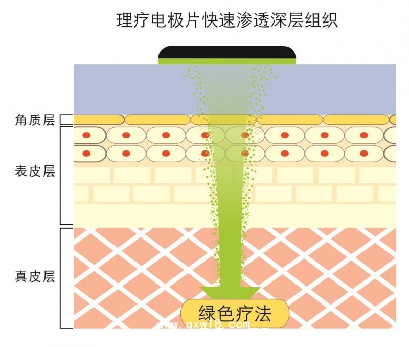 透化治療系統(tǒng)