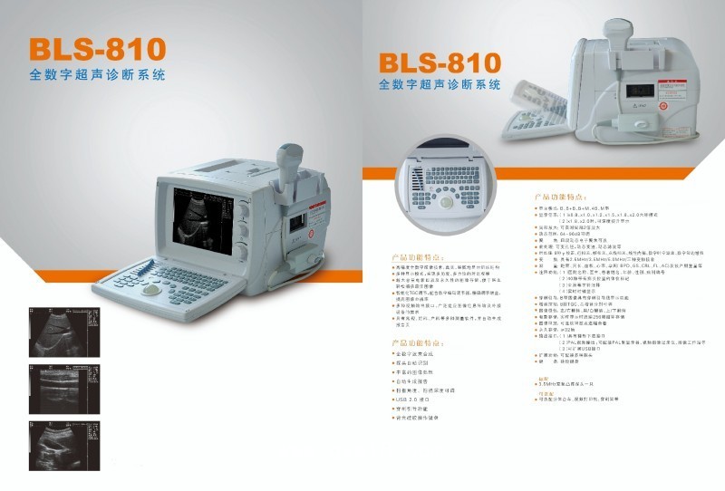 全數(shù)字超聲診斷系統(tǒng)