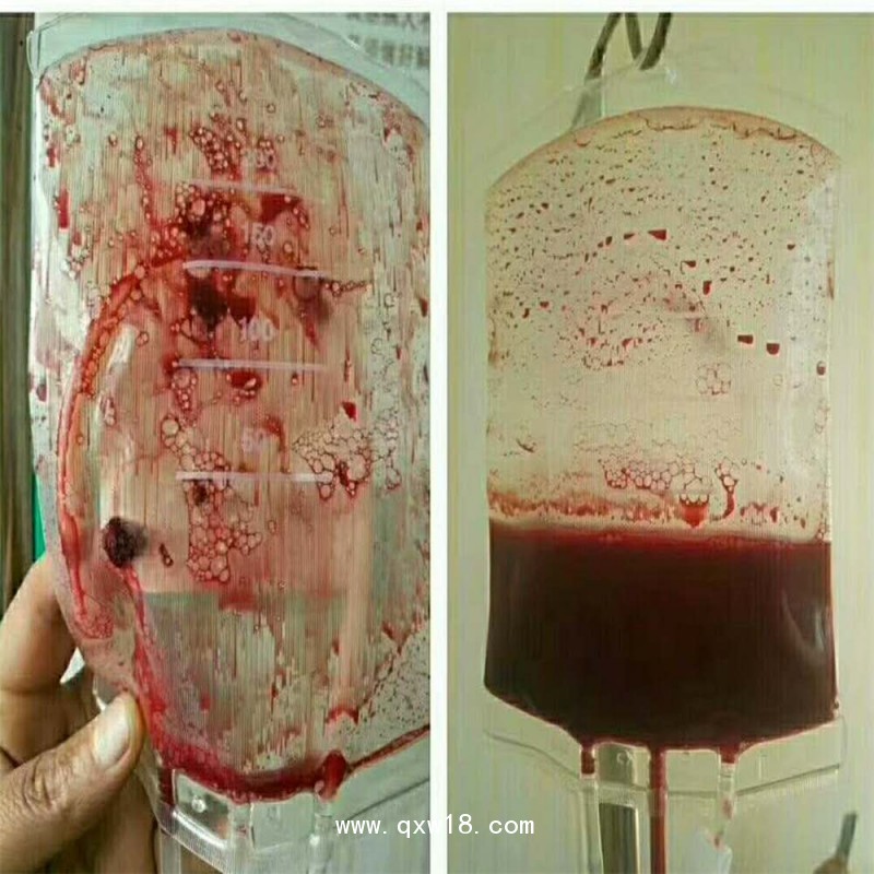 血袋、大自血血袋三大廠家南京賽爾金、蘇州萊仕、四川南格爾