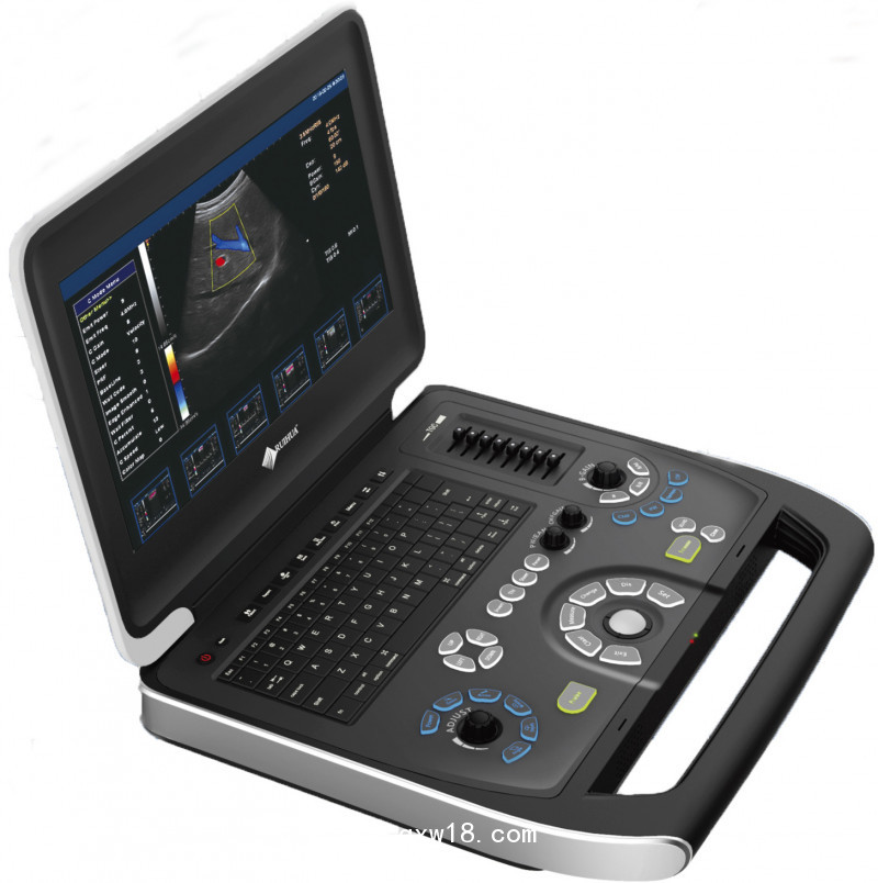 江蘇供應(yīng)彩超系列筆記本彩超四維彩超