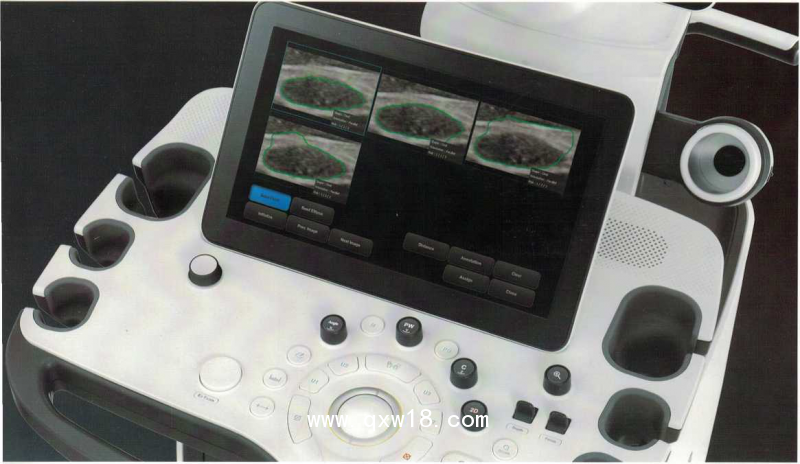 三星麥迪遜彩超機(jī)XR80A