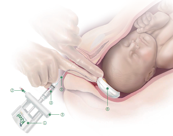美國進口KIWI胎頭真空吸引器