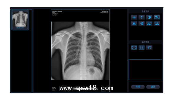 國內(nèi)品牌 移動(dòng)式X光機(jī) X射線拍片機(jī)