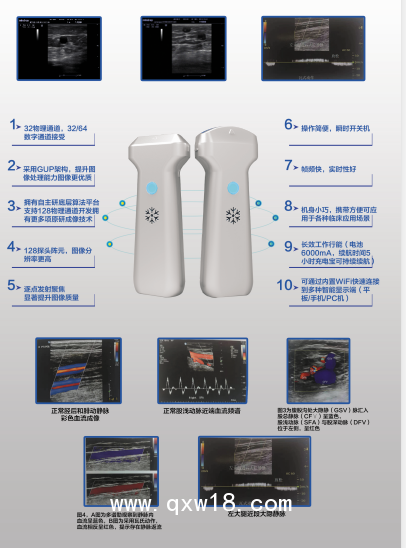 便攜式掌上彩超