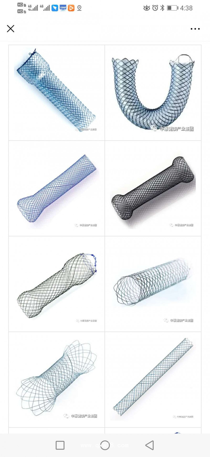 不銹鋼支架/鎳鈦合金支架