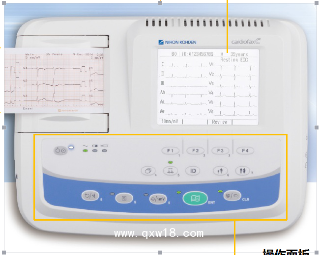 上海光電三道心電圖機(jī)專業(yè)分析系統(tǒng)