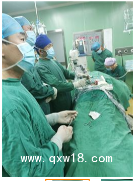 UBE器械包，UBE融合器械包，UBE大直徑消融電極