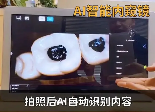 EZ·小雅口腔內窺鏡