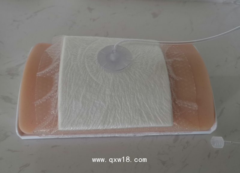 泉志 新一代一次性負(fù)壓引流護(hù)創(chuàng)材料（VSD+VAC）