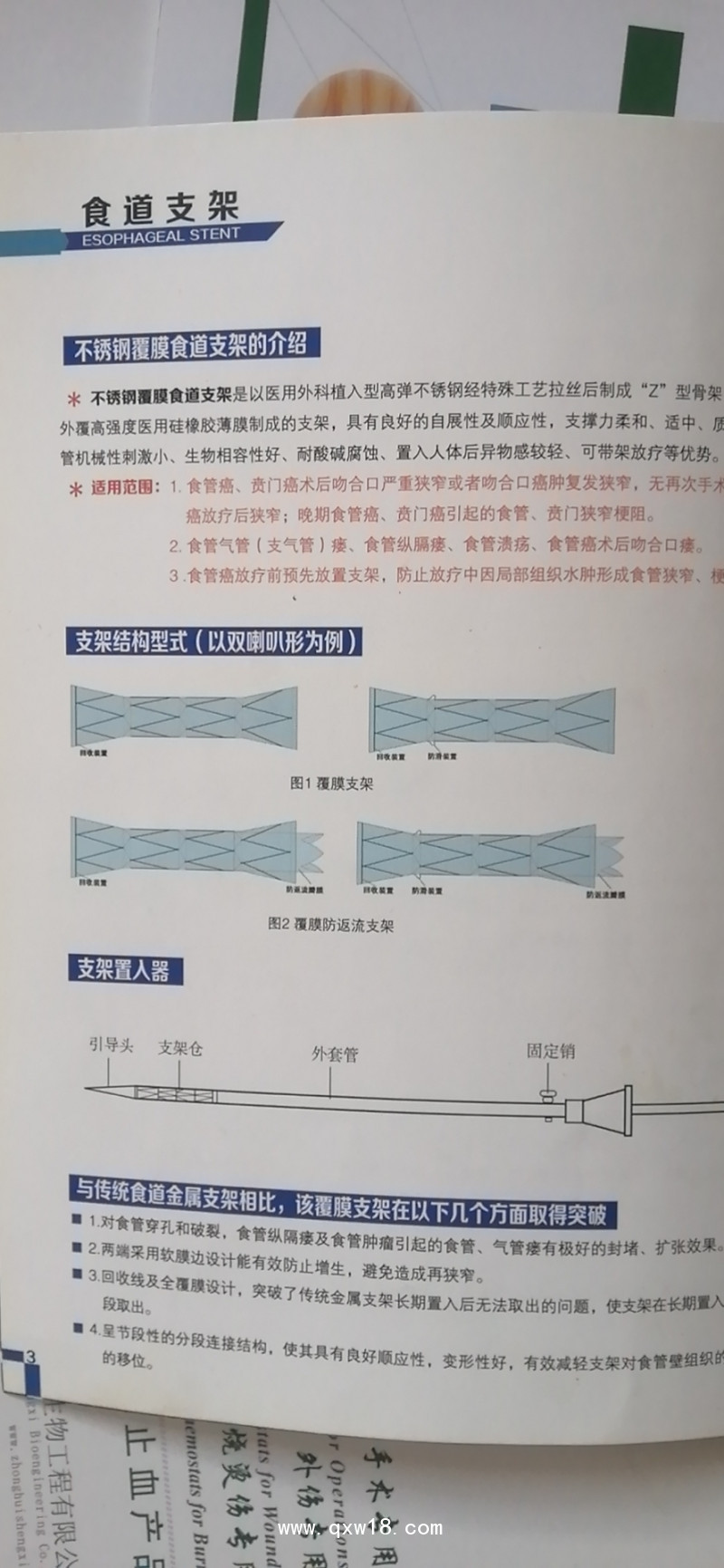 不銹鋼/食道支架/腹膜食道支架