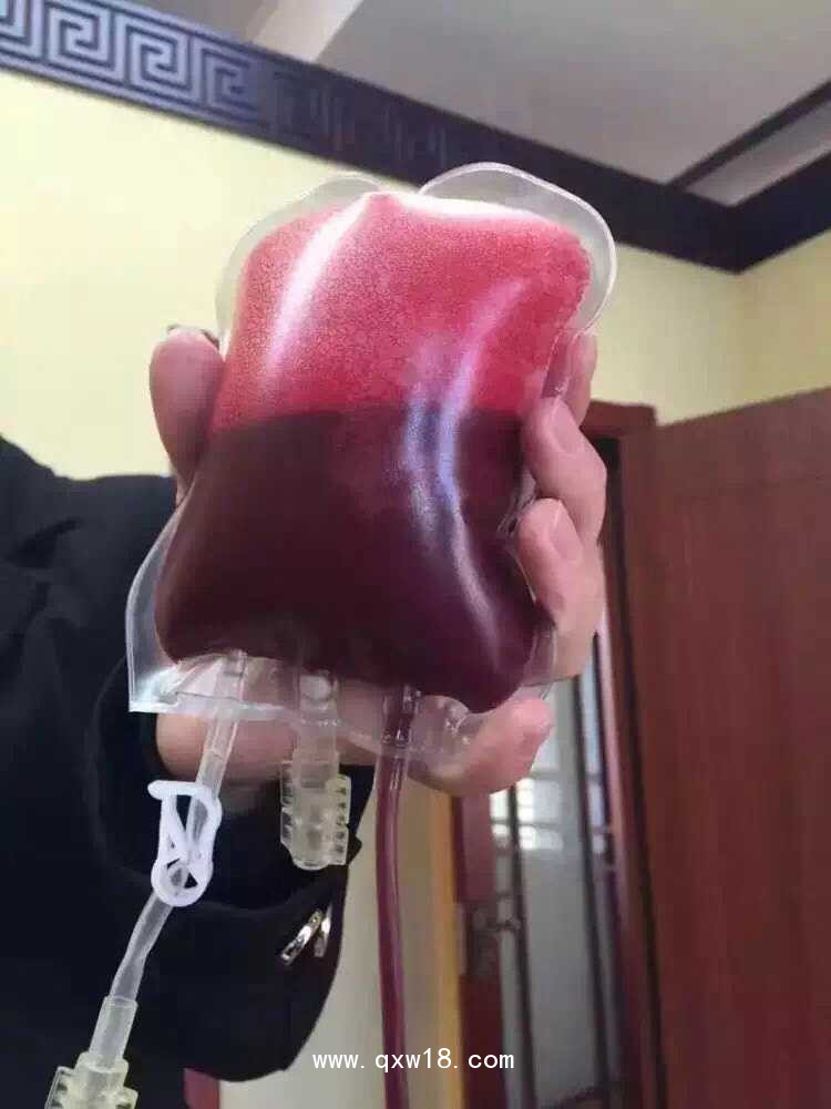 醫(yī)用臭氧治療儀―臭氧大自血回輸療法→帶狀皰疹治療