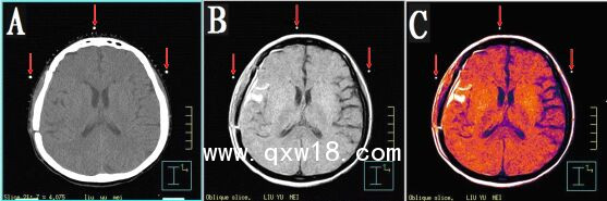 醫(yī)學圖像體外定位貼（MK⊙CT／MR）