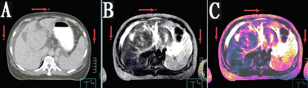 醫(yī)學圖像體外定位貼（MK⊙CT／MR）