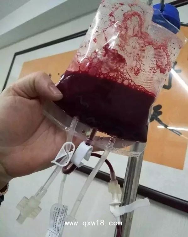 一次性大自血血袋，一次性輸血器，醫(yī)用臭氧儀等耗材產(chǎn)品批發(fā)