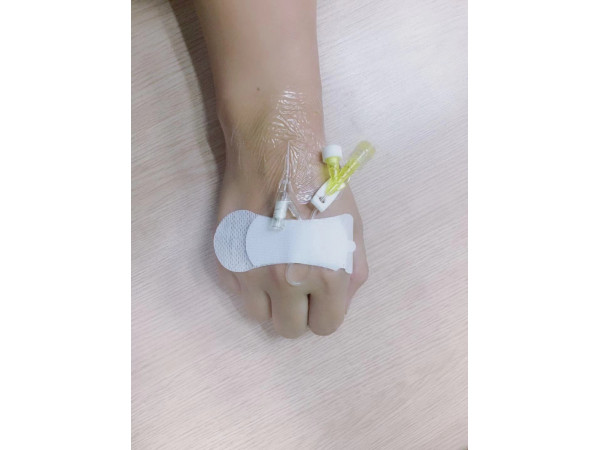 一次性使用無(wú)菌敷貼A5