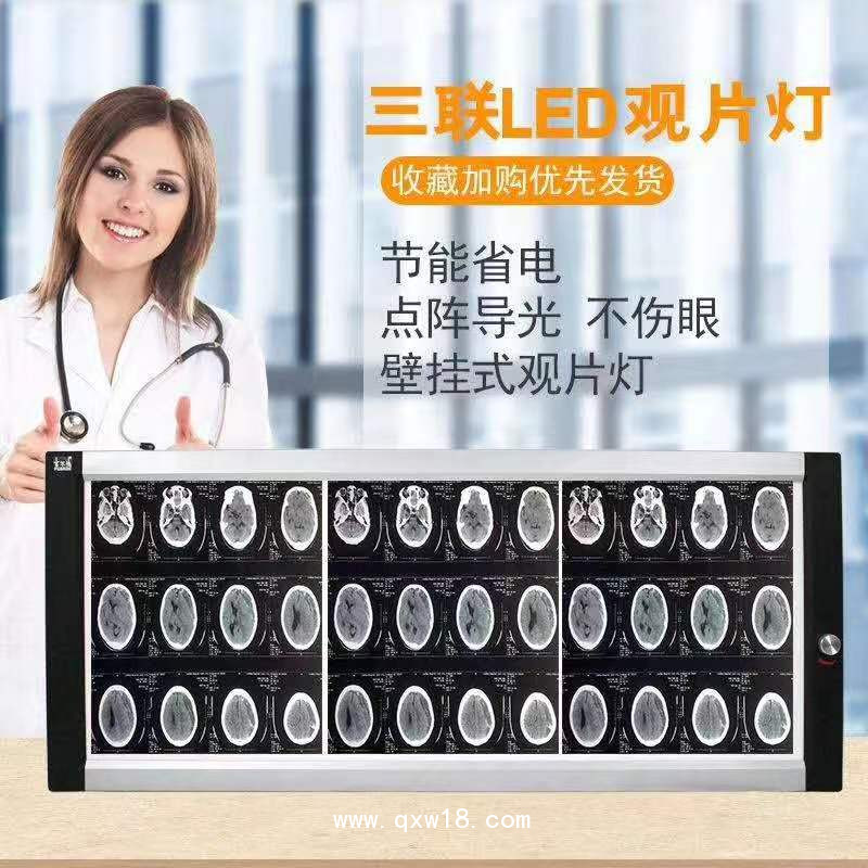 欣雨辰 YC-GP X射線(xiàn)膠片觀片燈 單聯(lián)/雙聯(lián)/三聯(lián)/四聯(lián)