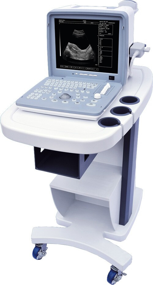 全數字超聲顯像診斷儀廠家直銷便攜式黑白B超機