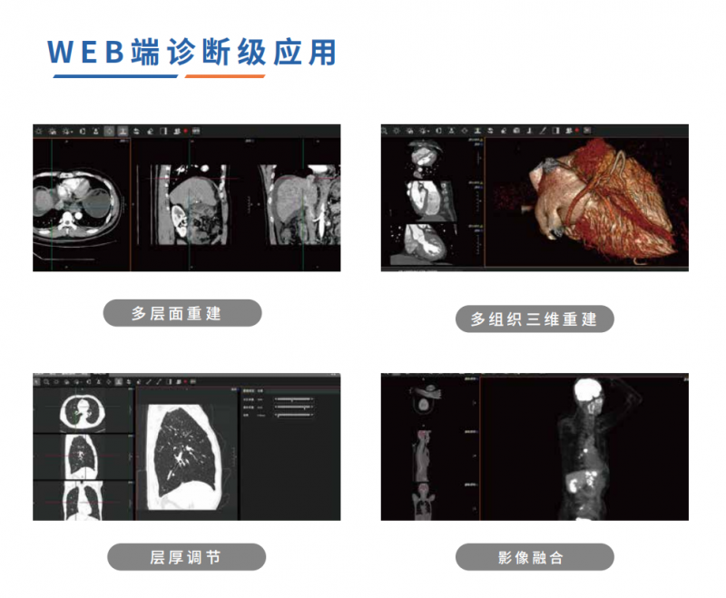 全球影像·數(shù)字影像服務(wù)(云膠片)