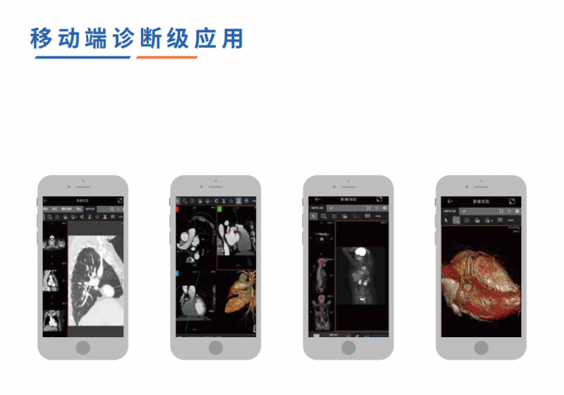 全球影像·數(shù)字影像服務(wù)(云膠片)