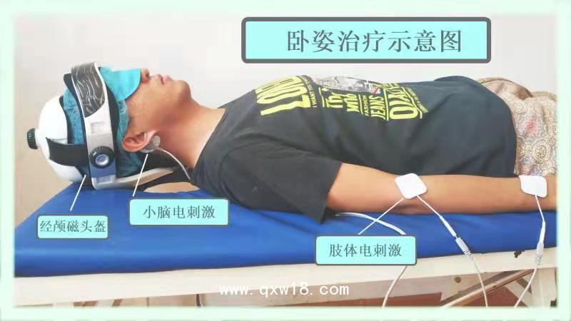 初鴻腦循環(huán)功能障礙治療儀廠家 小兒腦癱治療儀 腦功能障礙