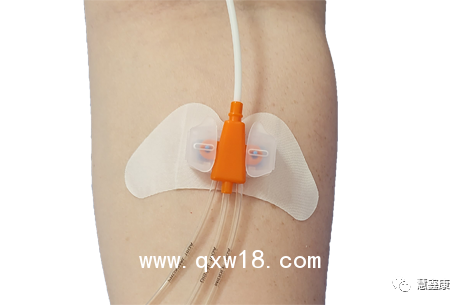 中心靜脈導管固定器-思樂扣