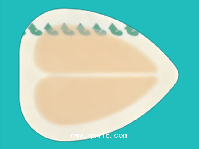 一次性使用無(wú)菌敷貼（壓瘡褥瘡貼）