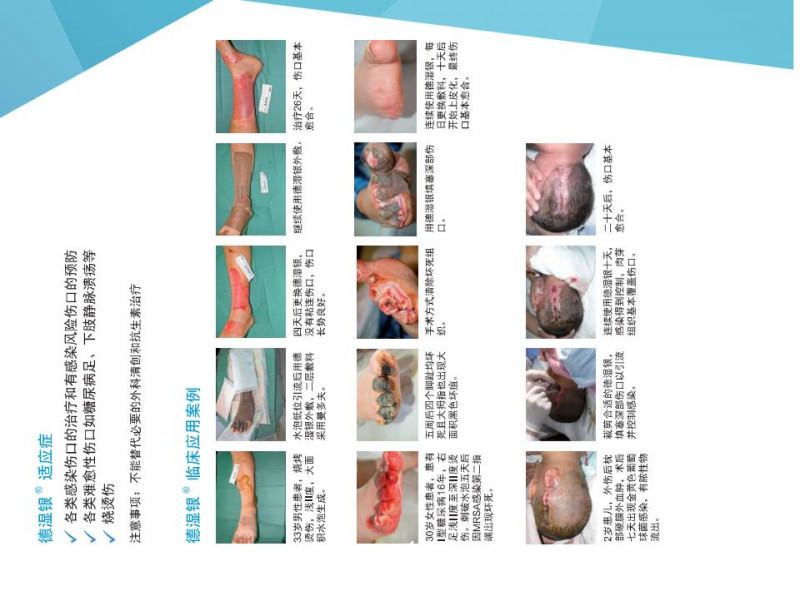 德濕銀敷料、銀離子