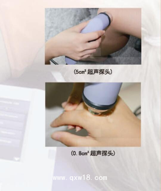 荷蘭恩諾超聲波治療儀 Sonopuls 190