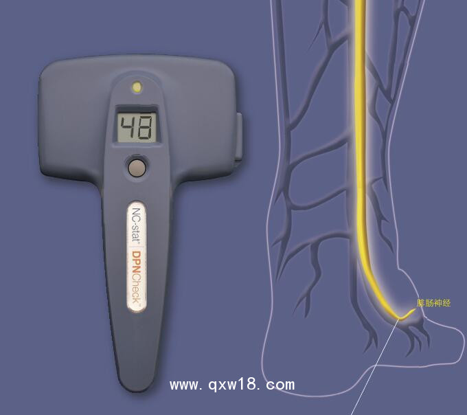 紐諾麥斯神經(jīng)傳導(dǎo)速度測(cè)量?jī)x NC-stat DPNCheck