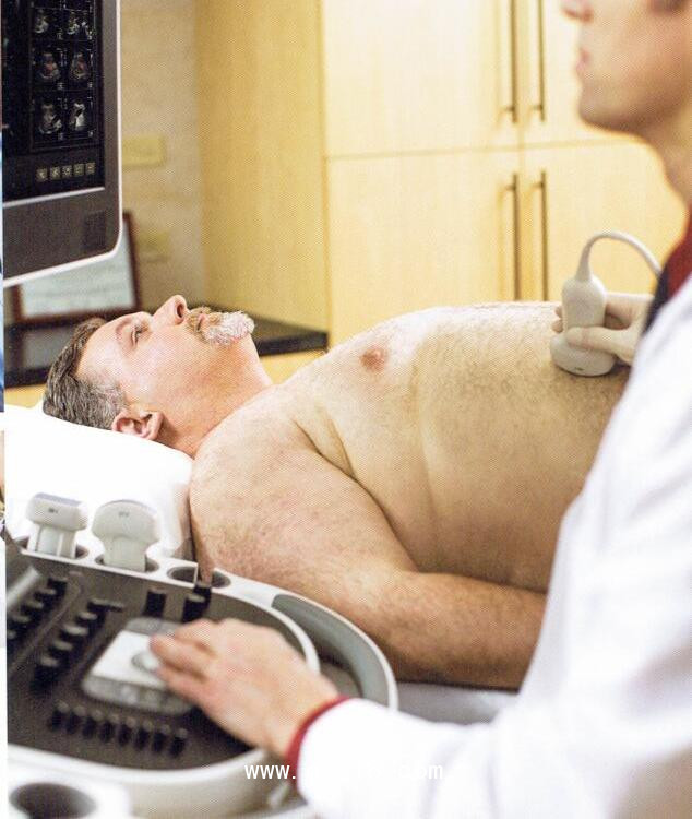 飛利浦 多普勒超聲診斷儀 EPIQ 7