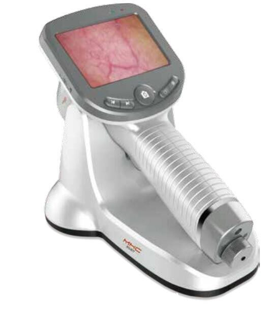 創(chuàng)弘醫(yī)用電子皮膚鏡影像系統(tǒng) CH-DSIS-2000