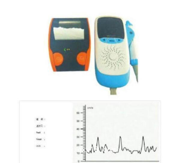 原位超聲多普勒血流檢測儀 YW-100