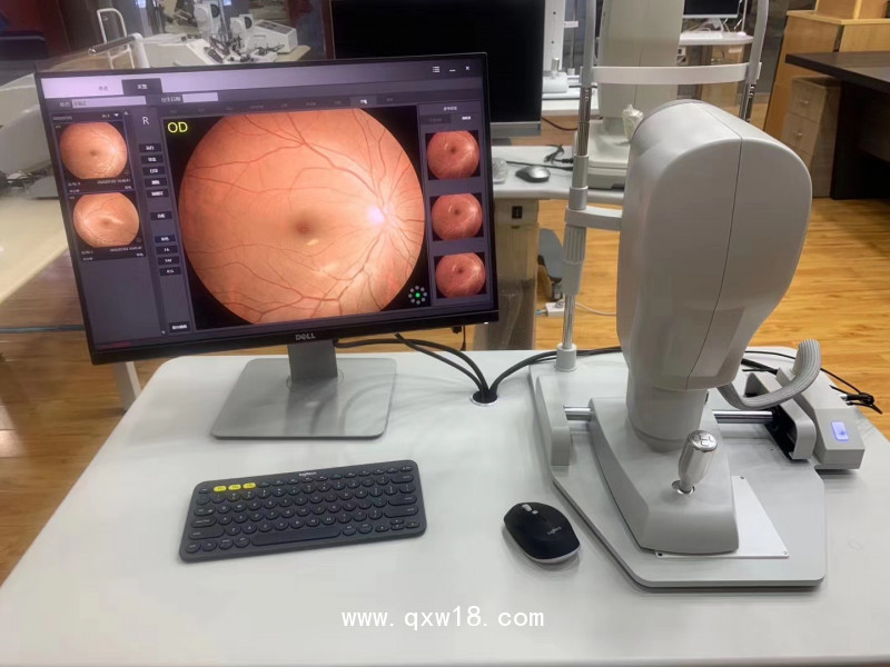 SW-8800免散瞳數(shù)碼眼底照相機(jī)