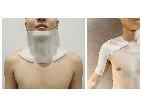 醫(yī)用外固定可塑性?shī)A板(含硅酮凝膠)