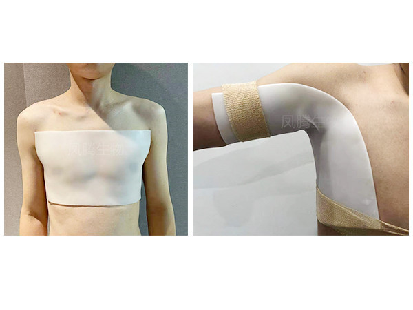 醫(yī)用外固定可塑性?shī)A板(含硅酮凝膠)