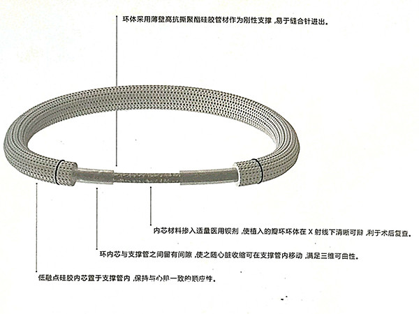 佰仁思瓣膜成形環(huán)