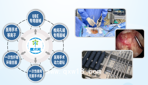 纖維環(huán)縫合器術(shù)