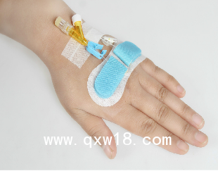 體表導(dǎo)管固定器