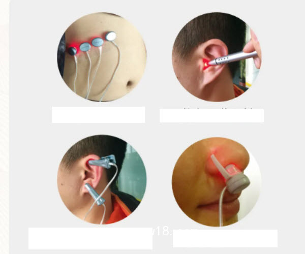 XS-998D06型激光穴位治療儀