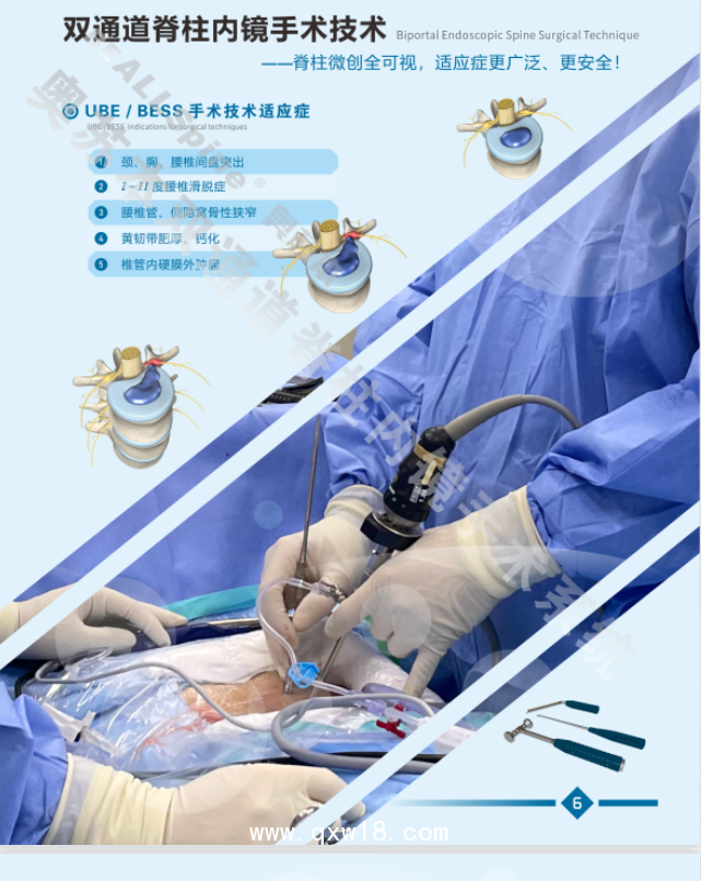 UBE單側(cè)雙通道脊柱微創(chuàng)手術(shù)相比其他手術(shù)方式